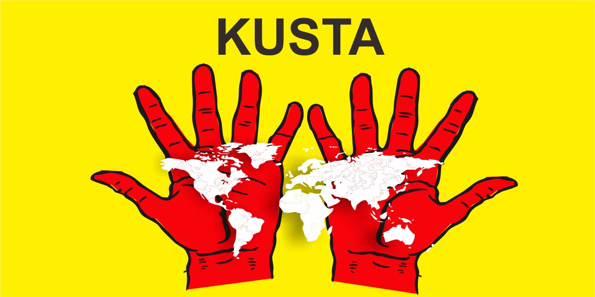 Kusta Kusta
