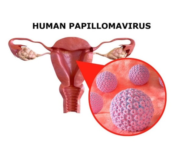 Deteksi Dini Kanker Serviks, Tiga Warga Pekalongan Teridentifikasi HPV DNA
